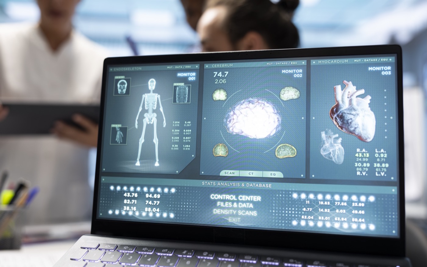 Interpretación de un trazo de electrocardiograma