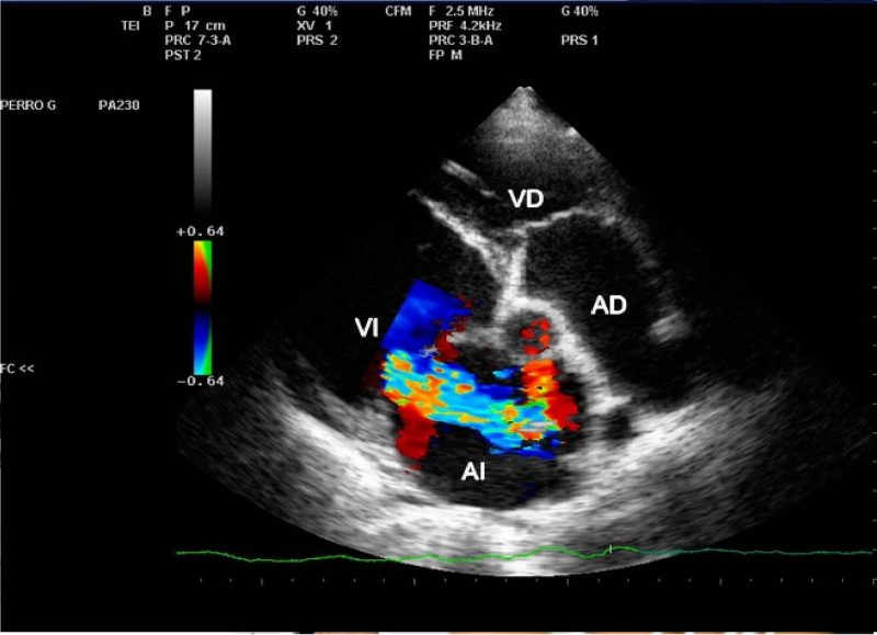 Ecocardiograma + Doppler Color - Cardiologo Tijuana - Cardiologia ...